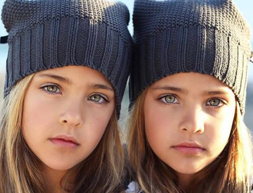“Most Beautiful Twins” In The World, Birth to 2024