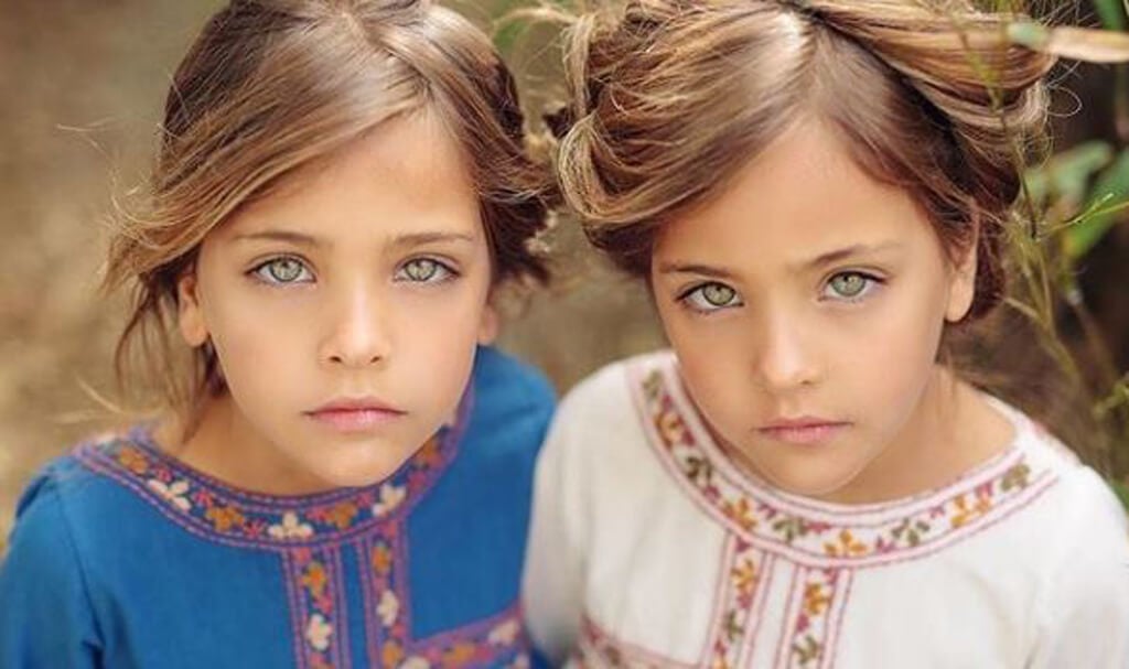 The Controversial Internet Fame of the “Most Beautiful Twins” In The World