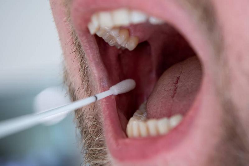 Close-up of a person's open mouth showing teeth and tongue, with a cotton swab being inserted for a sample collection